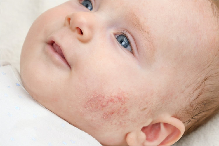 Crema facial para bebés - Cuidados piel bebé