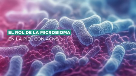 El rol del microbioma en la piel con acné