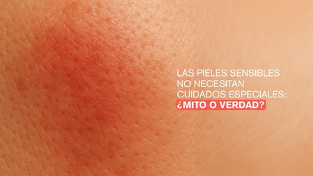 Las pieles sensibles no necesitan cuidados especiales: ¿Mito o verdad?